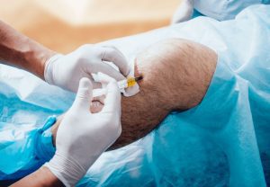 regenerative medicine